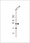 RAB8A Antibody